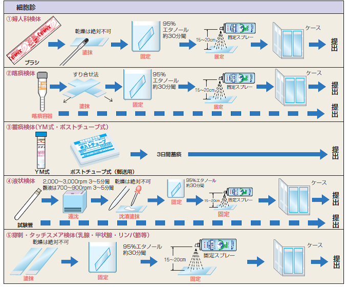 尿細胞診およびその他の尿検査